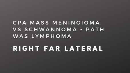 CPA Mass Meningioma vs Schwannoma - path was Lymphoma